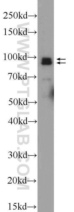NARG1 Rabbit anti-Human, Polyclonal, Proteintech:Antibodies:Primary Antibodies