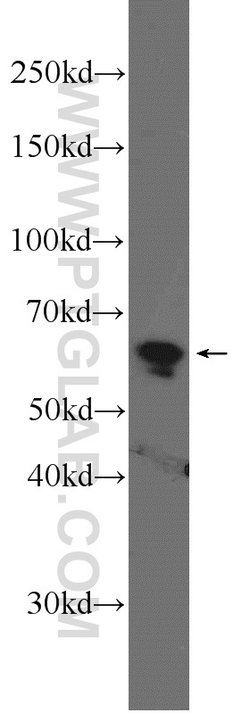 USP39 Rabbit anti-Human, Polyclonal, Proteintech 150 &mu;L; Unconjugated:Antibodies,