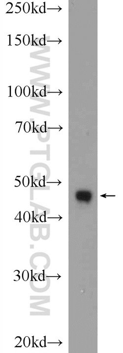 CEP55 Rabbit anti-Human, Mouse, Rat, Polyclonal, Proteintech 150 &mu;L;