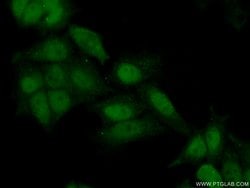 ATAD2 Rabbit anti-Human, Polyclonal, Proteintech 150 &mu;L; Unconjugated:Antibodies,