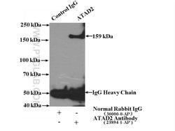 ATAD2 Rabbit anti-Human, Polyclonal, Proteintech 150 &mu;L; Unconjugated:Antibodies,