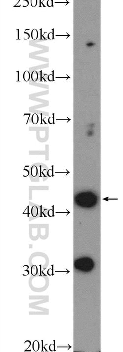 BTBD8 Rabbit anti-Human, Polyclonal, Proteintech 20 &mu;L; Unconjugated:Antibodies,
