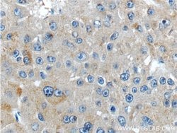 IGHMBP2 Rabbit anti-Human, Polyclonal, Proteintech 150 &mu;L; Unconjugated:Antibodies,