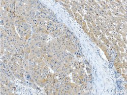 IGHMBP2 Rabbit anti-Human, Polyclonal, Proteintech 150 &mu;L; Unconjugated:Antibodies,