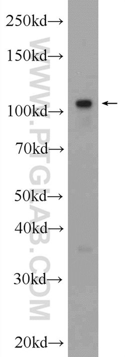 IGHMBP2 Rabbit anti-Human, Polyclonal, Proteintech 150 &mu;L; Unconjugated:Antibodies,