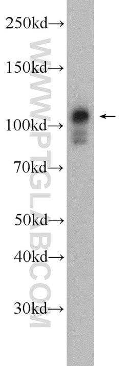 IGHMBP2 Rabbit anti-Human, Polyclonal, Proteintech 150 &mu;L; Unconjugated:Antibodies,