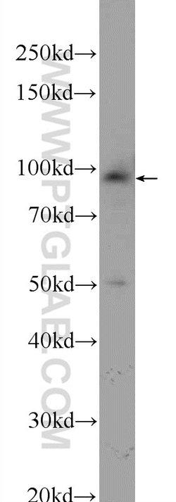 STRN3 Rabbit anti-Human, Mouse, Rat, Polyclonal, Proteintech:Antibodies:Primary