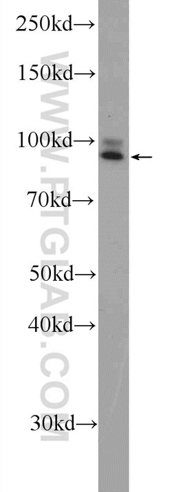 STRN3 Rabbit anti-Human, Mouse, Rat, Polyclonal, Proteintech:Antibodies:Primary