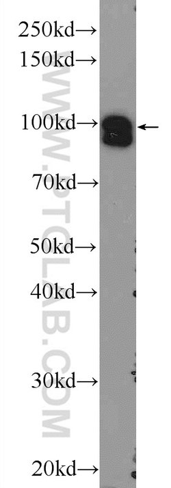 STRN3 Rabbit anti-Human, Mouse, Rat, Polyclonal, Proteintech:Antibodies:Primary