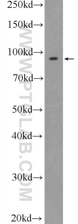 STRN3 Rabbit anti-Human, Mouse, Rat, Polyclonal, Proteintech:Antibodies:Primary
