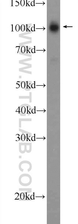 STRN3 Rabbit anti-Human, Mouse, Rat, Polyclonal, Proteintech:Antibodies:Primary