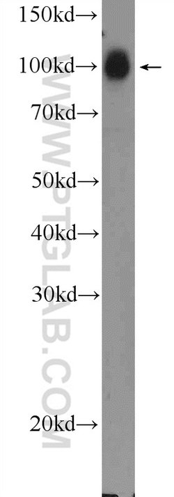 STRN3 Rabbit anti-Human, Mouse, Rat, Polyclonal, Proteintech:Antibodies:Primary