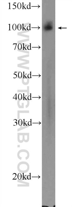 STRN3 Rabbit anti-Human, Mouse, Rat, Polyclonal, Proteintech:Antibodies:Primary