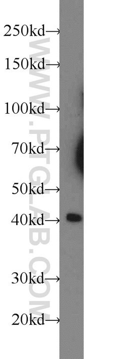 XKR6 Rabbit anti-Human, Polyclonal, Proteintech:Antibodies:Primary Antibodies