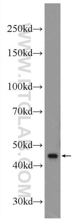 XKR6 Rabbit anti-Human, Polyclonal, Proteintech:Antibodies:Primary Antibodies
