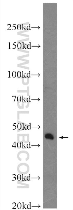 XKR6 Rabbit anti-Human, Polyclonal, Proteintech:Antibodies:Primary Antibodies