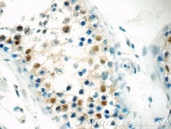BARHL2 Rabbit anti-Human, Mouse, Polyclonal, Proteintech 150 &mu;L; Unconjugated:Antibodies,
