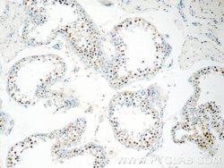 BARHL2 Rabbit anti-Human, Mouse, Polyclonal, Proteintech 150 &mu;L; Unconjugated:Antibodies,