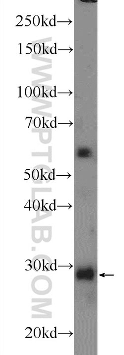 TMEM55B Rabbit anti-Human, Mouse, Polyclonal, Proteintech:Antibodies:Primary