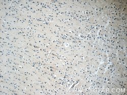 TFAM Rabbit anti-Human, Polyclonal, Proteintech:Antibodies:Primary Antibodies