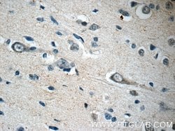 TFAM Rabbit anti-Human, Polyclonal, Proteintech:Antibodies:Primary Antibodies