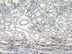TFAM Rabbit anti-Human, Polyclonal, Proteintech:Antibodies:Primary Antibodies