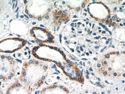 TFAM Rabbit anti-Human, Polyclonal, Proteintech:Antibodies:Primary Antibodies