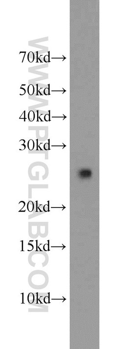TFAM Rabbit anti-Human, Polyclonal, Proteintech:Antibodies:Primary Antibodies