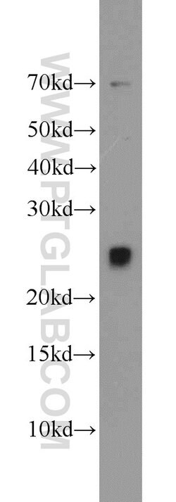 TFAM Rabbit anti-Human, Polyclonal, Proteintech:Antibodies:Primary Antibodies