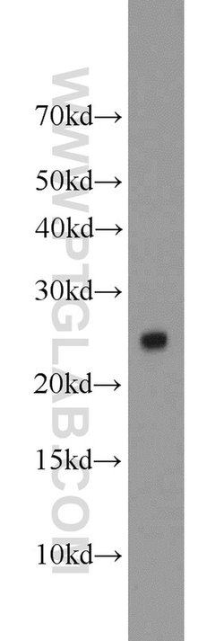TFAM Rabbit anti-Human, Polyclonal, Proteintech:Antibodies:Primary Antibodies