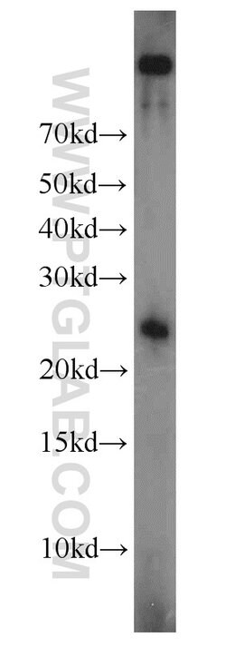 TFAM Rabbit anti-Human, Polyclonal, Proteintech:Antibodies:Primary Antibodies