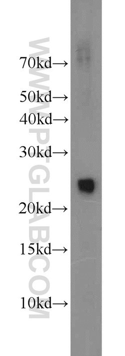 TFAM Rabbit anti-Human, Polyclonal, Proteintech:Antibodies:Primary Antibodies