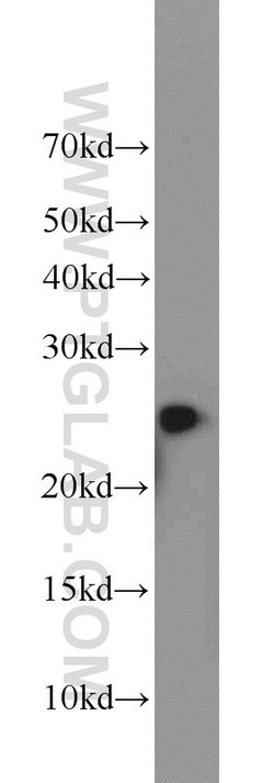 TFAM Rabbit anti-Human, Polyclonal, Proteintech:Antibodies:Primary Antibodies