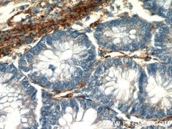 AMPD3 Rabbit anti-Human, Mouse, Rat, Polyclonal, Proteintech:Antibodies:Primary