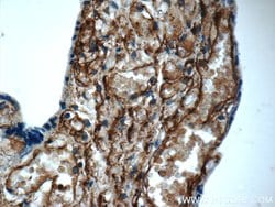 AMPD3 Rabbit anti-Human, Mouse, Rat, Polyclonal, Proteintech:Antibodies:Primary