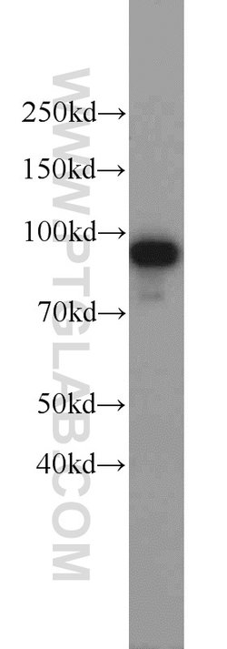 AMPD3 Rabbit anti-Human, Mouse, Rat, Polyclonal, Proteintech:Antibodies:Primary