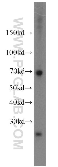 AMPD3 Rabbit anti-Human, Mouse, Rat, Polyclonal, Proteintech:Antibodies:Primary