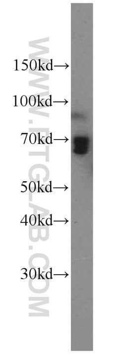 AMPD3 Rabbit anti-Human, Mouse, Rat, Polyclonal, Proteintech:Antibodies:Primary