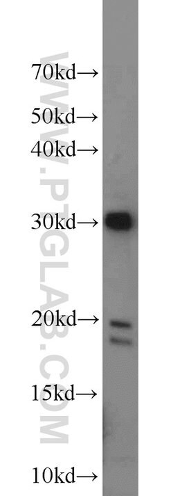 CXorf56 Rabbit anti-Human, Mouse, Polyclonal, Proteintech 150 &mu;L; Unconjugated:Antibodies,