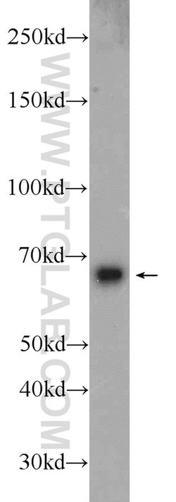 B4GALNT2 Rabbit anti-Human, Polyclonal, Proteintech 150 &mu;L; Unconjugated:Antibodies,