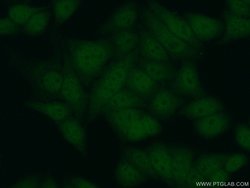 PCNA Rabbit anti-Human, Mouse, Rat, Polyclonal, Proteintech 150 &mu;L;