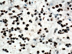 PCNA Rabbit anti-Human, Mouse, Rat, Polyclonal, Proteintech 150 &mu;L;