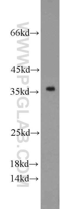 PCNA Rabbit anti-Human, Mouse, Rat, Polyclonal, Proteintech 150 &mu;L;