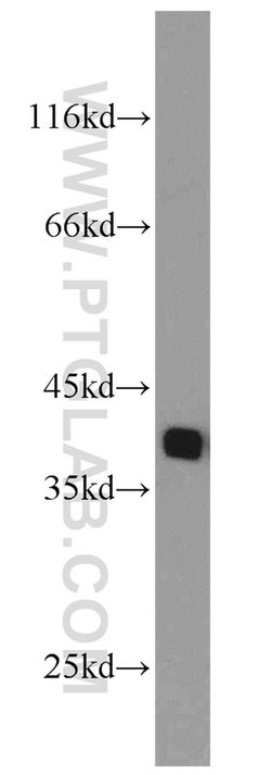 PCNA Rabbit anti-Human, Mouse, Rat, Polyclonal, Proteintech 150 &mu;L;