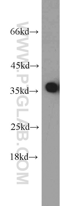 PCNA Rabbit anti-Human, Mouse, Rat, Polyclonal, Proteintech 150 &mu;L;