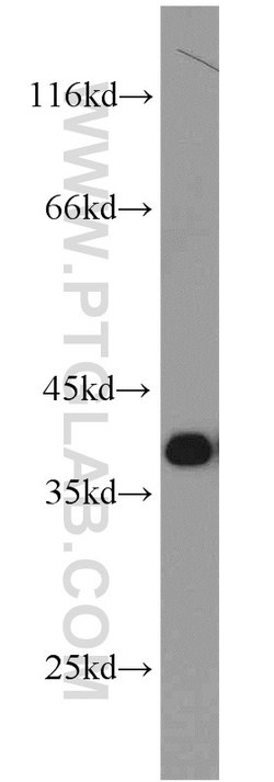 PCNA Rabbit anti-Human, Mouse, Rat, Polyclonal, Proteintech 150 &mu;L;