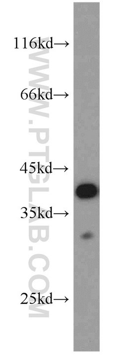 PCNA Rabbit anti-Human, Mouse, Rat, Polyclonal, Proteintech 150 &mu;L;
