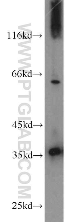 PCNA Rabbit anti-Human, Mouse, Rat, Polyclonal, Proteintech 150 &mu;L;
