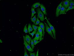 ZDHHC9 Rabbit anti-Human, Mouse, Polyclonal, Proteintech 150 &mu;L; Unconjugated:Antibodies,