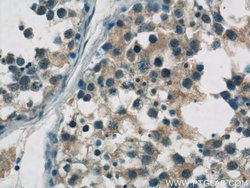 ZDHHC9 Rabbit anti-Human, Mouse, Polyclonal, Proteintech 150 &mu;L; Unconjugated:Antibodies,